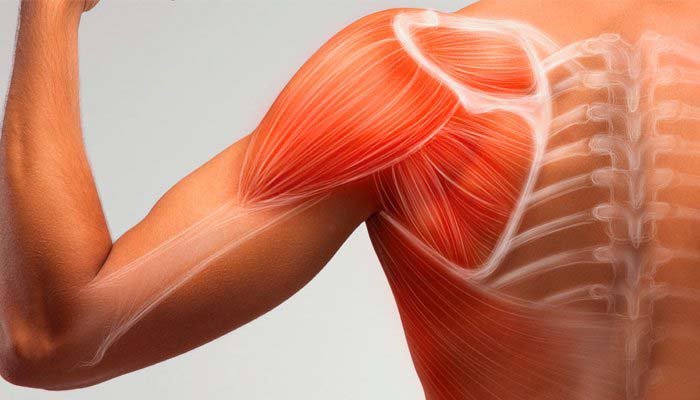 Lesão do Manguito Rotador – A lesão mais comum no ombro